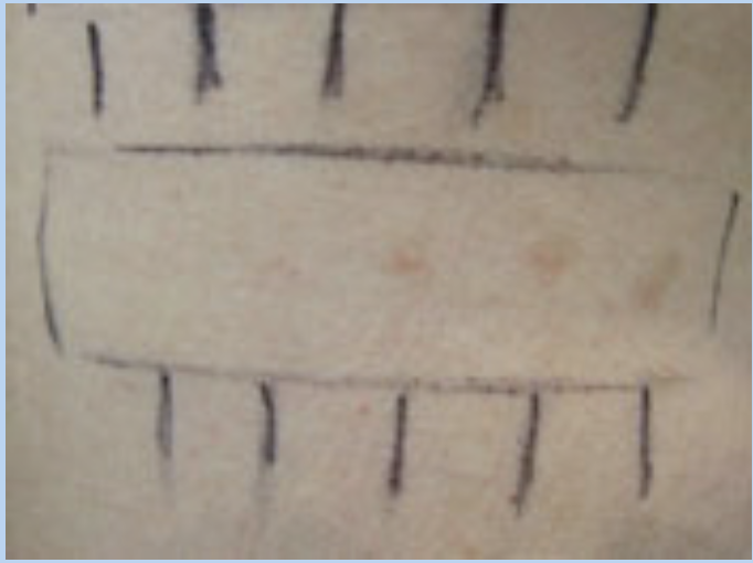 Przykład pomiaru o różnych natężeniach promieniowania UVB